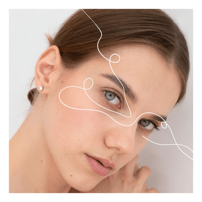 Blefaroplastie