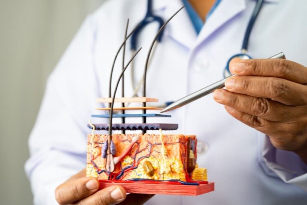 Abordare personalizata și experiență internațională în transplantul de păr