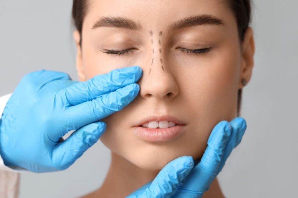 Cum decurge procedura de rinoplastie la Soma Clinic